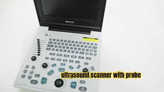 equipamento médico saferlife Scanner de ultrassom